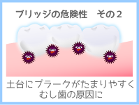 ブリッジの危険その2