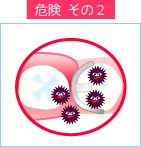 入れ歯の危険性２